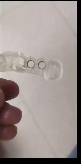 Resin Dental 3D Printer Planti - огляд і ціна 3D Printing Liquid